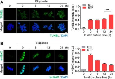 Increased WIP1 Expression With Aging Suppresses the Capacity of Oocytes to Respond to and Repair DNA Damage